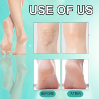 3PCS Heel Repair Balm - Coconut Oil Heel Balm Stick,Cracked Heel Repair Cream,Dry Skin Remover Feet, Foot Balm for Dry & Cracked,Deeply Hydrates Skin,Restores Skin Moisture,Foot Care