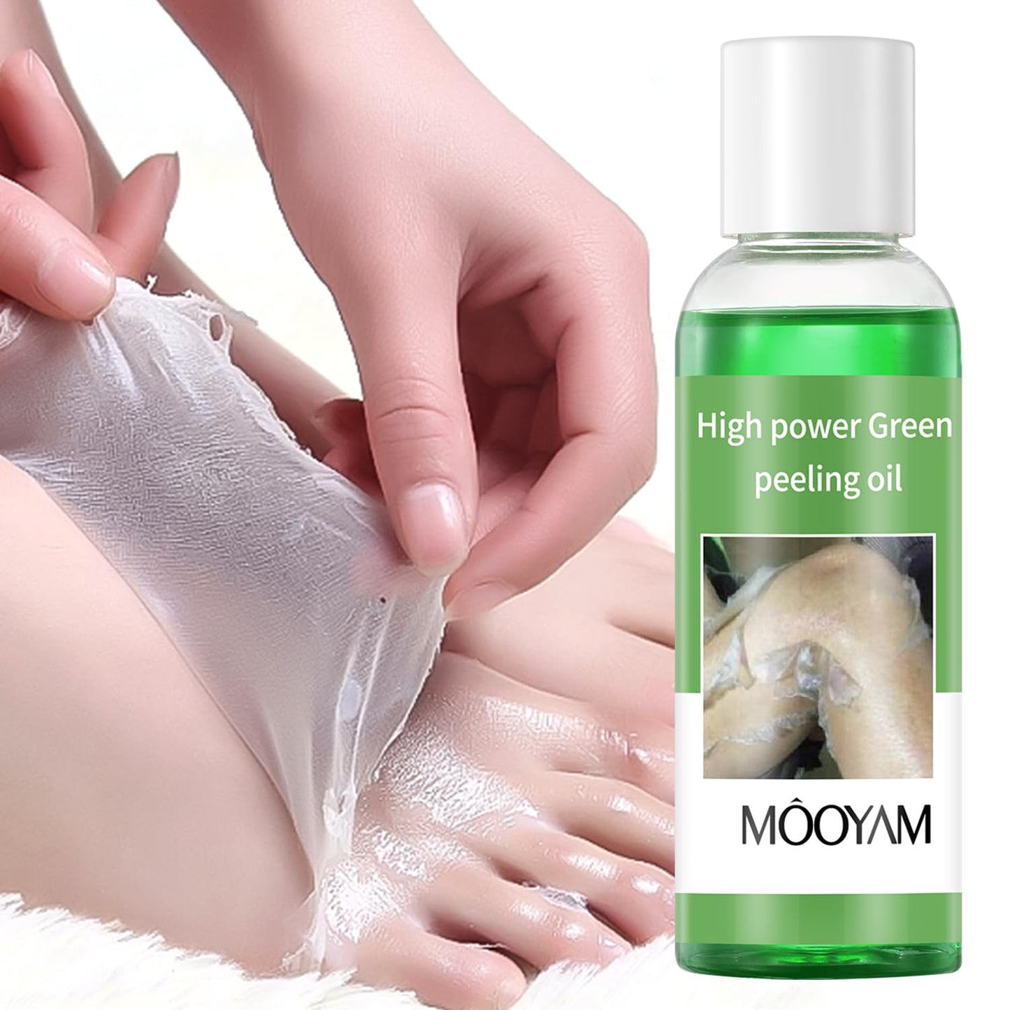 Exfoliating Green Peeling Oil for Extra Strength Exfoliation, Exfoliating Peeling Solution for Body and Face Skin Peeling Chemical Peel At Home