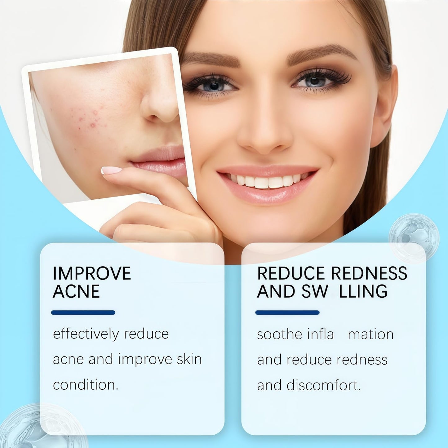 Retinol Gel,Acne Treatment Gel,Acne Control Cream for Face,Anti Acne Gel for Spot Prone Skin,Retinol Moisturizer Cream,Brightens Skin and Improves Elasticity,Face for Pimple Reduce,Without Over Drying