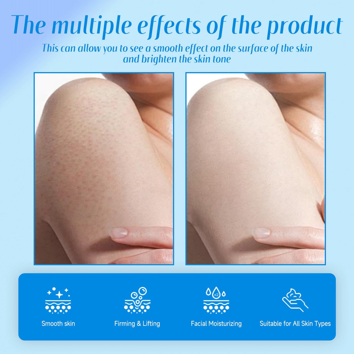 Strawberry Legs Treatment Body Cream,Keratosis Pilaris Cream Treatment with Vitamin E and Urea,Skin Exfoliating Repair Cream for Chicken Skin Treatment,Eliminates Strawberry Spots(30G)