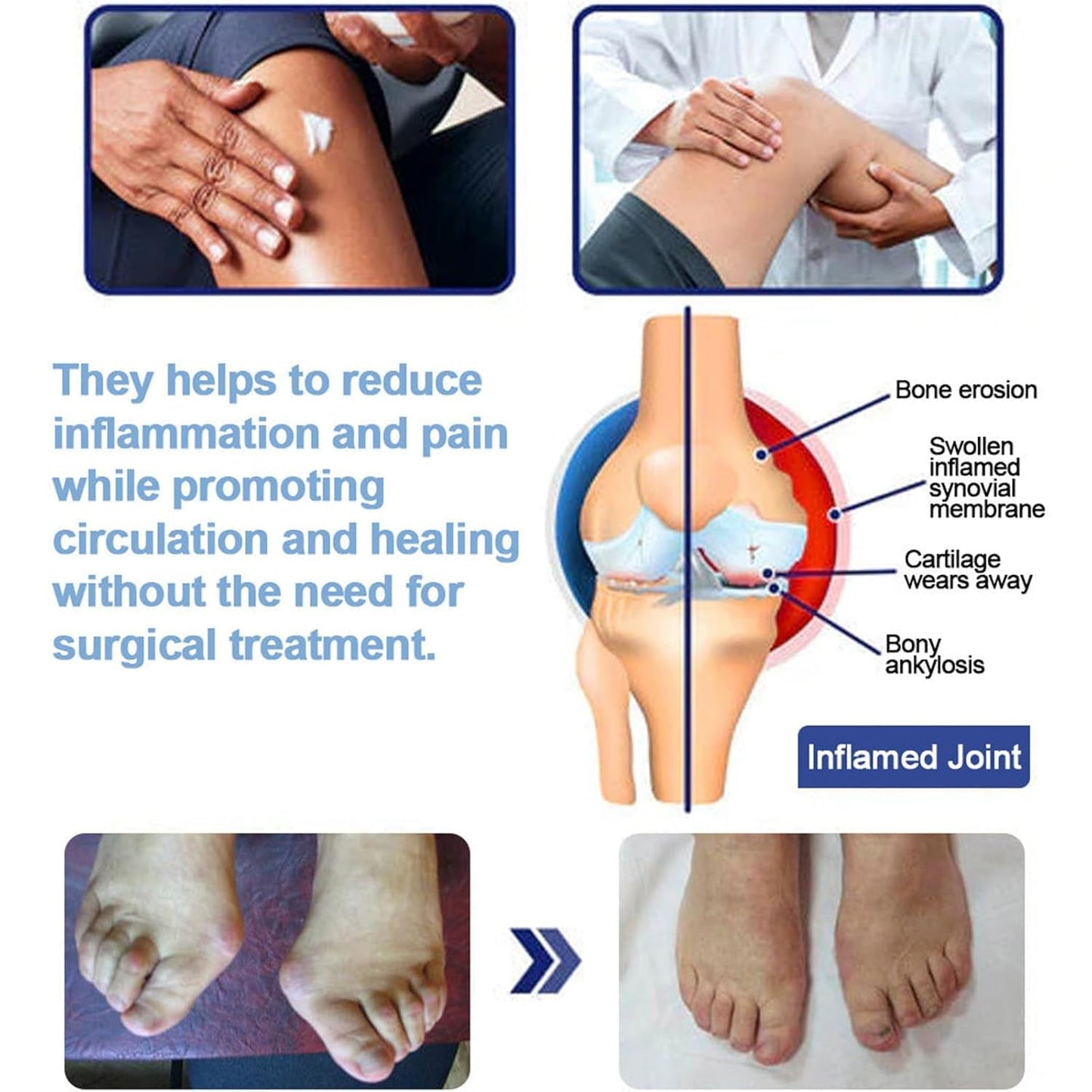 KoolShiro 2Pcs Magnesium Pa-in Relief Cream, Professional Joint Magnesium Cream for Relief, Natural Joint Gel Effective Relieffor Back, Neck, Hands, Knees