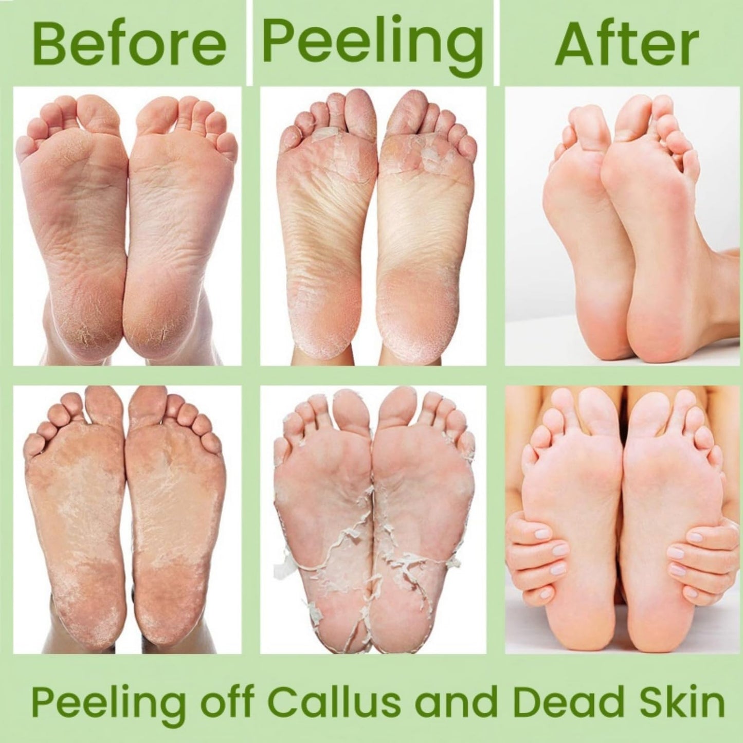 Ruojiar 4 Pairs Natural Aloe Vera Gel Foot Mask,Exfoliating Foot Peel Mask,Aloe Vera Peeling Foot Mask,Aloe Moisturizing Feet Peeling Mask,Foot Peel Mask for Hard Skin,Effective Exfoliating Feet Peeling Socks