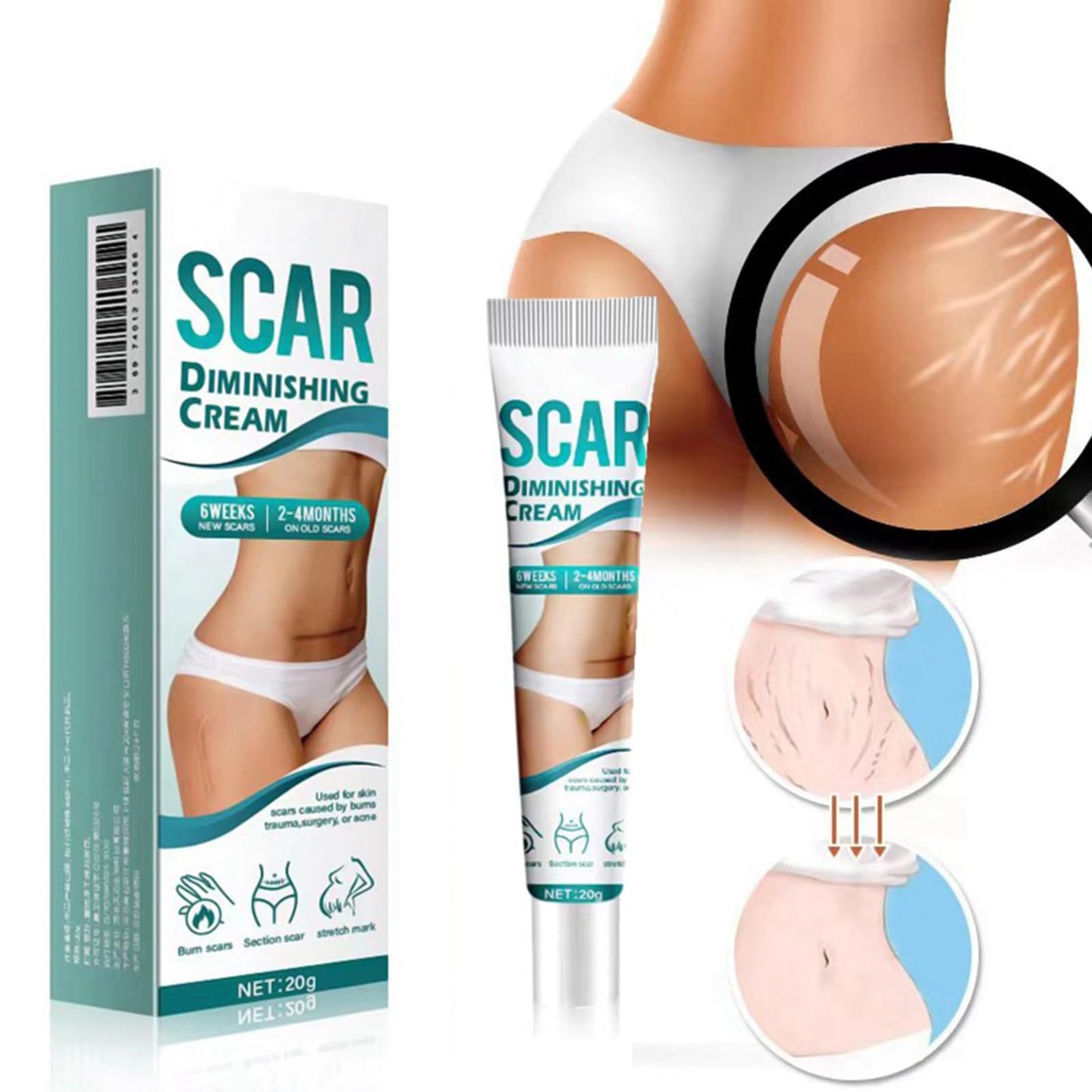 AuraBeen Scar Cream for Face & Body - Assists in Enhancing The Look of Stretch Marks, C - Section Scars, Surgical Scars - Suited for Old & New Scars - Facilitates Skin Restoration