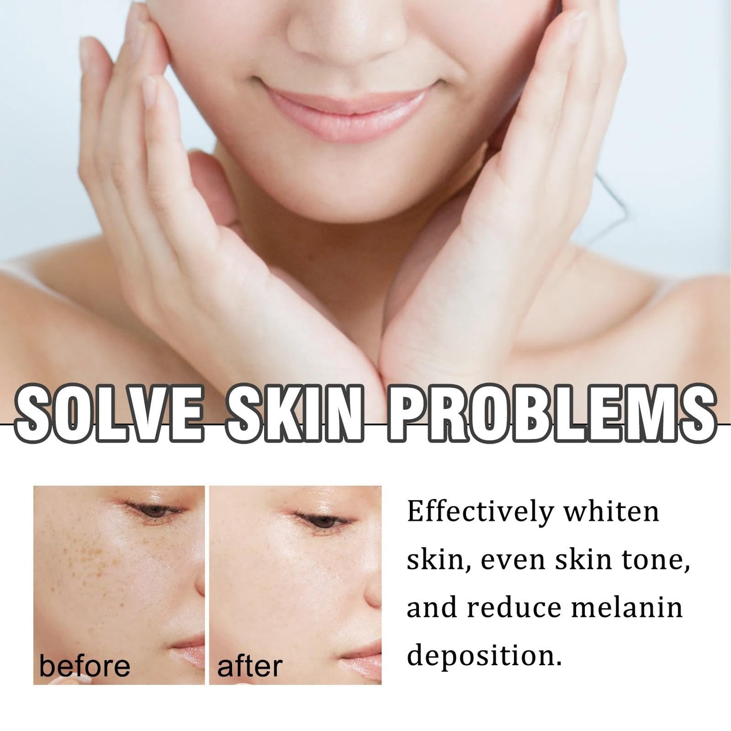 Dark Spot Remover Serum,D/ark S/pot Corrector Daily Face S/erum,Da/rk Sp/ot Correcting Glow Se/rum,Dark Spo/t Remover,Spot Treatment,Moisturiser Fa/ce Women,Face Oils for Women,Hydrating Serum