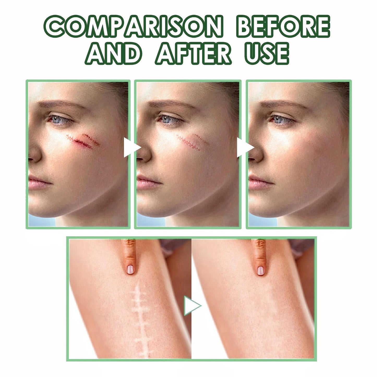OuXing Wound Healing Oint-Ment,Relieve Skin Abrasions,Natral Healing Cream,Promote Skin HEA/ling Cream,Scab He/aling Cr/eam,Wo/und Cre/am Fade Scars,Wo/und He/aling Crea/m,Body Cre/am,WOU/nd Protection