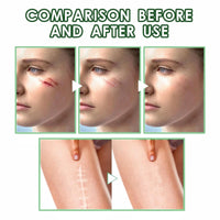 OuXing Wound Healing Oint-Ment,Relieve Skin Abrasions,Natral Healing Cream,Promote Skin HEA/ling Cream,Scab He/aling Cr/eam,Wo/und Cre/am Fade Scars,Wo/und He/aling Crea/m,Body Cre/am,WOU/nd Protection