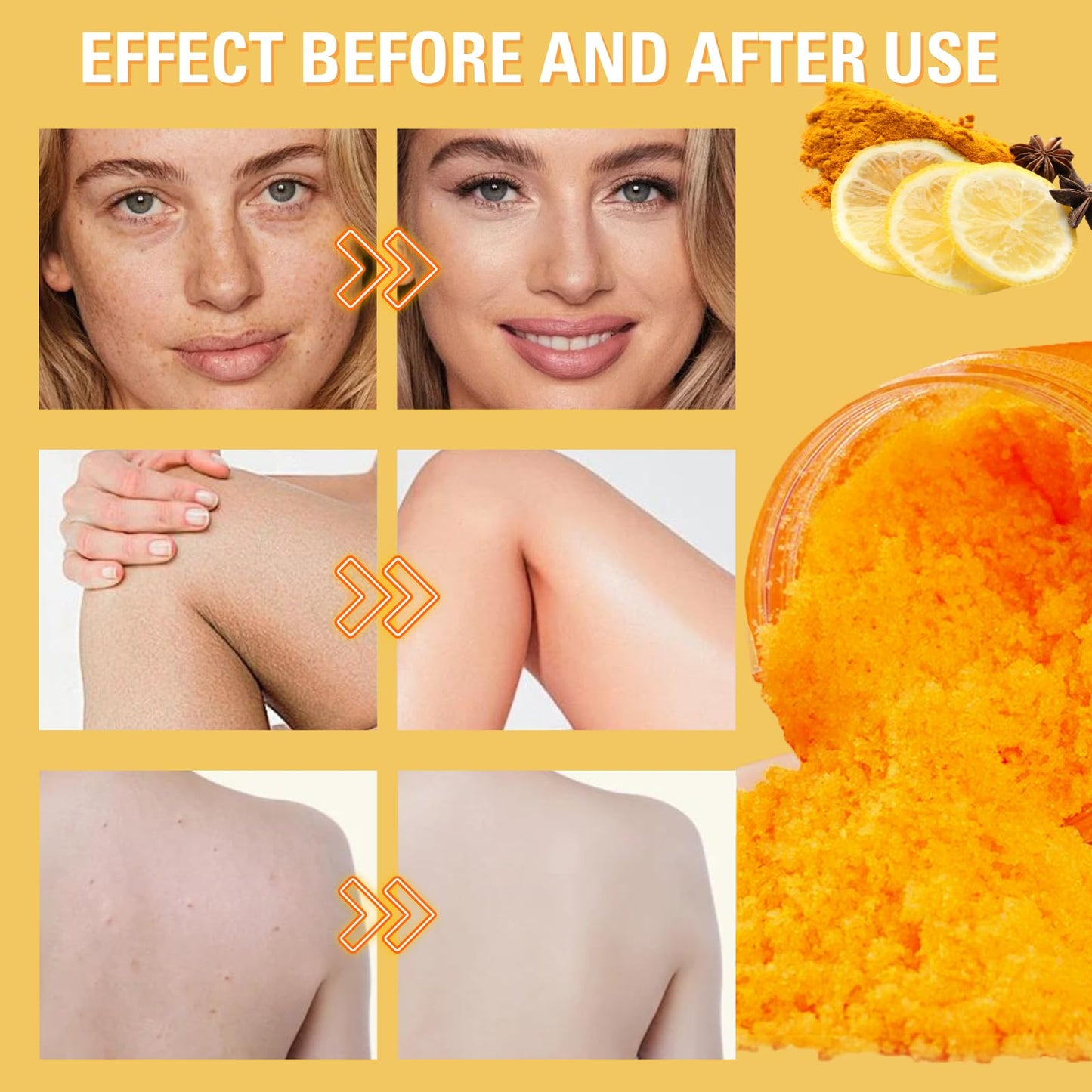 Turmeric And Vitamin C Body Scrub, Exfoliating Body Scrub With Turmeric, Dead Skin Remover For Body, Improve Dark Spots&Acne, Natural Deep Cleansing Body Scrub Exfoliator, Body Skin Care, 100g