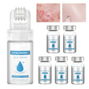 Leogony 5 PCS Serum Micro Infusion Facial System with Roller, Micro Infusion Facial System for Lips for Repair Skin Deep Nourishmen