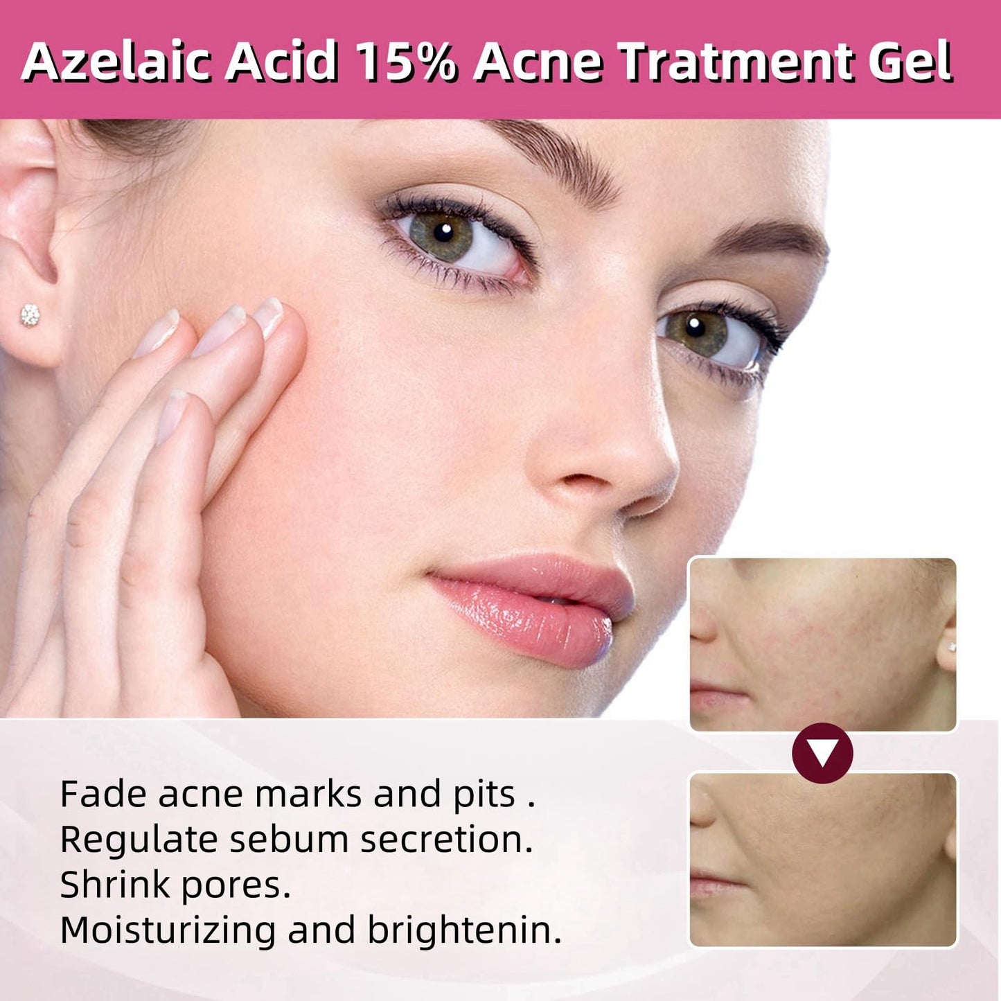 Azelaic Acid 15% Acne Tratment Gel,Azelaic Acid Serum Cream with Niacinamide & Vitamin C,Anti Acne Gel for Spot Prone Skin,Face Serum for Women,Hydrating Serum,Moisturiser Face,Serums Skincare