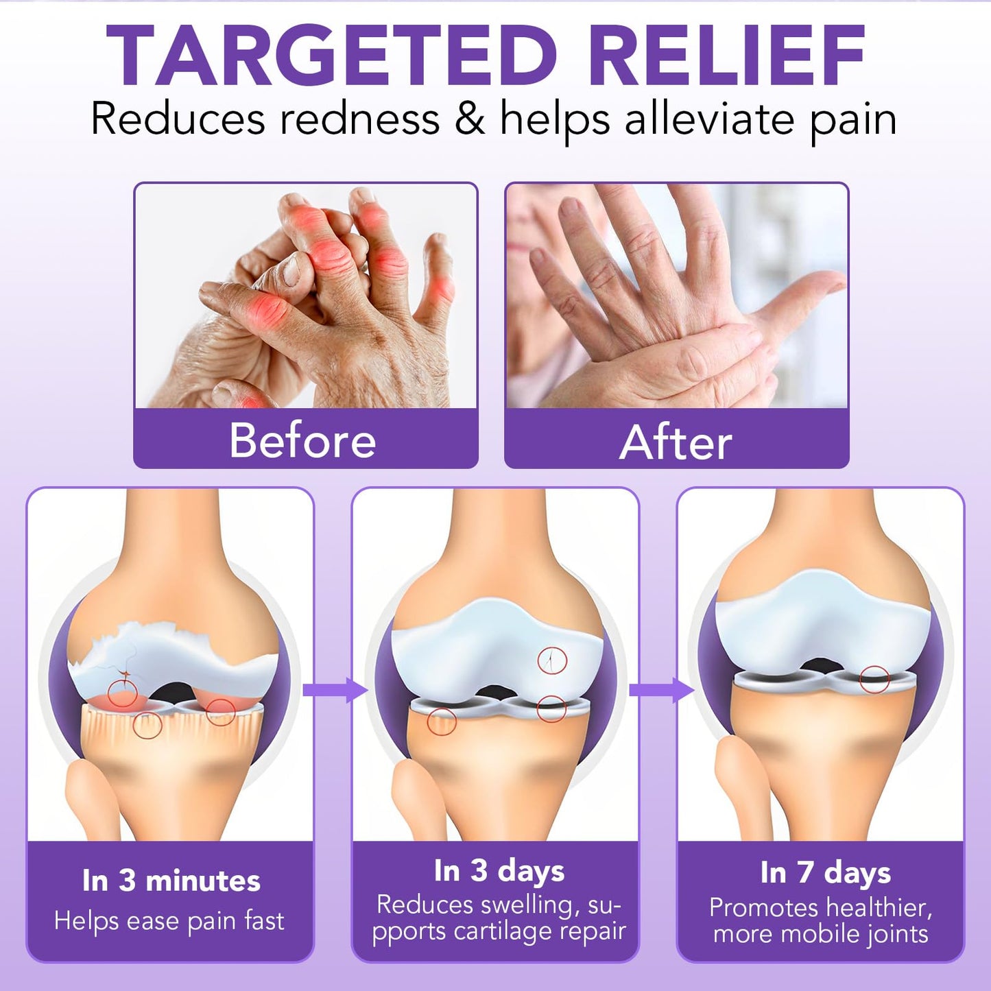 Massage Gel for Joint Activities Throughout The Body, Joint Pain Gel for Back, Muscles, Feet, Knees, Neck and Shoulders - Muscle Rub Rich in Natural Extracts 100g