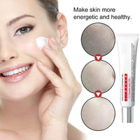 Azelaic Acid 15% Acne Tratment Gel,Azelaic Acid Serum Cream with Niacinamide & Vitamin C,Anti Acne Gel for Spot Prone Skin,Face Serum for Women,Hydrating Serum,Moisturiser Face,Serums Skincare