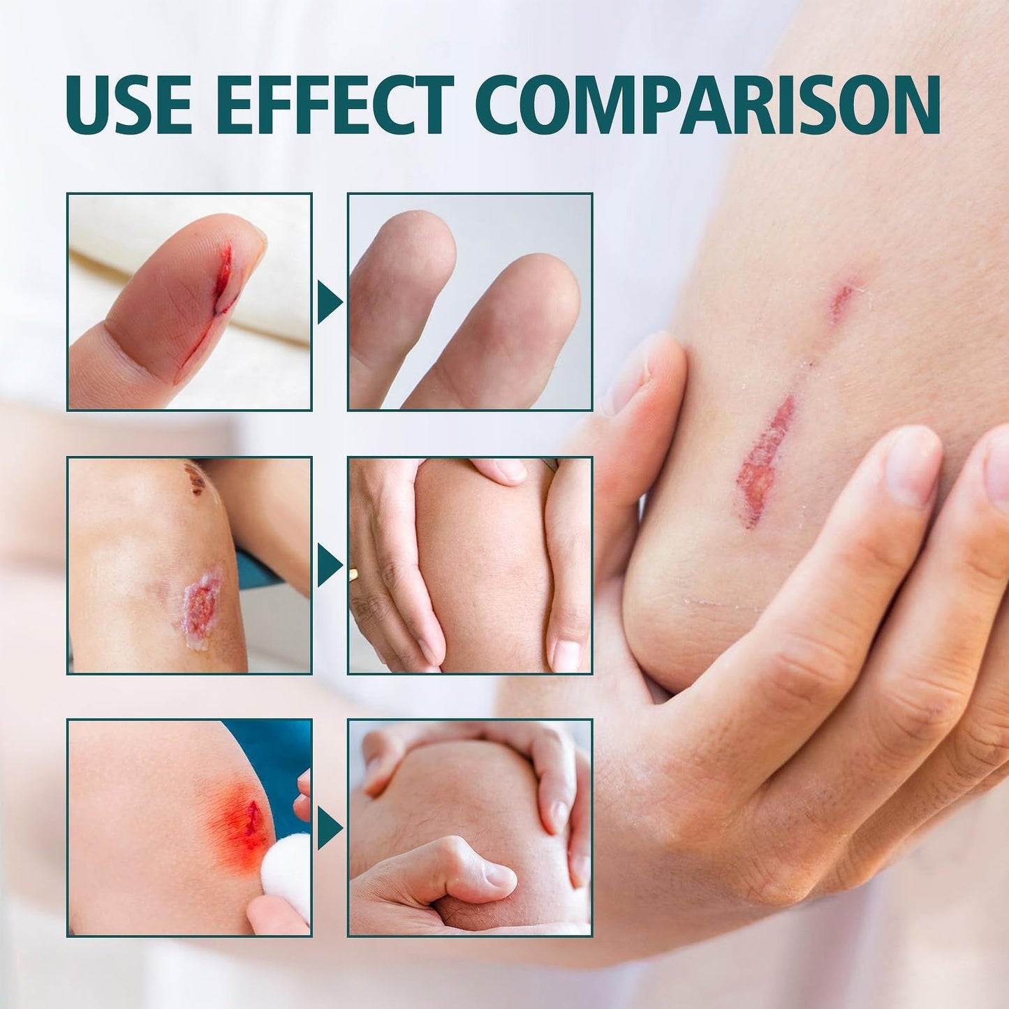 OuXing Wound Healing Oint-Ment,Relieve Skin Abrasions,Natral Healing Cream,Promote Skin HEA/ling Cream,Scab He/aling Cr/eam,Wo/und Cre/am Fade Scars,Wo/und He/aling Crea/m,Body Cre/am,WOU/nd Protection