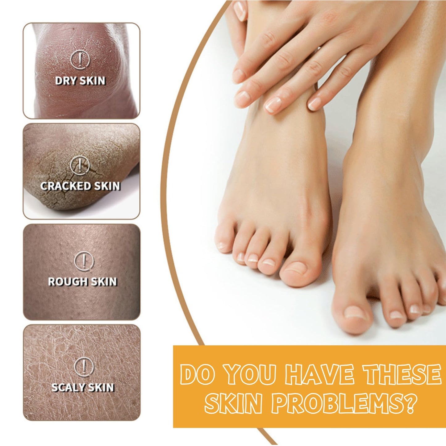 Trendyfave 60% Urea Cream For Cracked Heels - Urea Foot Cream - Foot Cream for Cracked Heels and Dry Skin - Cracked Heel Repair Cream - Skin Care Hands & Feet - Intense Moisturiser with Jojoba Oil & Aloe Vera