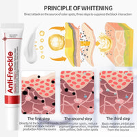 Tianyue Freckle Removal Cream,Anti-Freckle Crea-m- Dark Spot Removal Cream with Niacinamide & Vitamin C,Dark Spot Remover for Face & Body,Whitening Freckl-e Crea-m, Reduces Melasma,Improve Skin Dullness