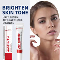 FHRKZZ Freckle Cream Vitamin C Freckle Cream for Adults with O+ Technology, Fades Dark Spots & Sun Spots, Brightens Dull Skin, Spot for Women - Improve Skin Dullness, Fade S-pots Blemishes