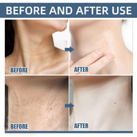 6PCS Firming Rejuvenating Neck Mask,Wrinkle Patches,Neck Mask for Tightening Firming,Forehead Wrin/kles Treatment,Ne/ck Tightening Mas/k with Hyaluronic Acid,Sheet Nec/k Ma/sks for Wrinkl/es