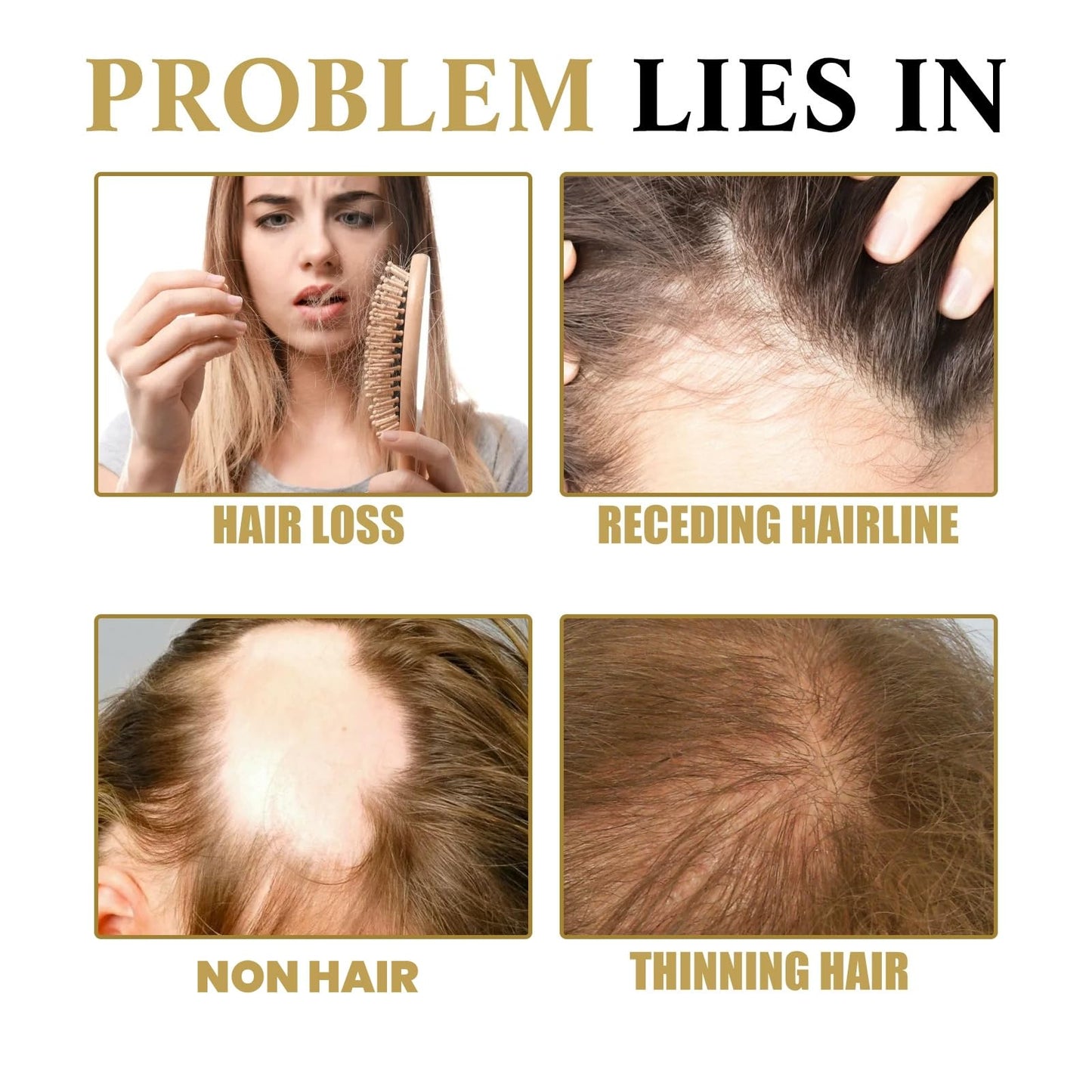 Oumun Hair Growth Serum,Hair Growth Roll-on Massage Essence,Hai-r Thickening Serum,Anti-Hai-r Loss,Fast Growing Ha-ir Gro-wth Ser-um,Ha-ir Ser-um for H-air Gro-wth,H-air Gr-owth Oil for Women