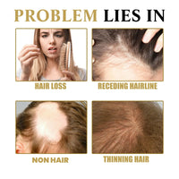 Oumun Hair Growth Serum,Hair Growth Roll-on Massage Essence,Hai-r Thickening Serum,Anti-Hai-r Loss,Fast Growing Ha-ir Gro-wth Ser-um,Ha-ir Ser-um for H-air Gro-wth,H-air Gr-owth Oil for Women