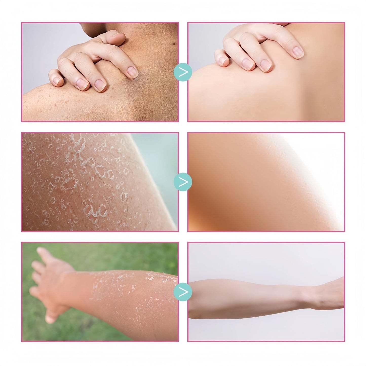 Xunzhi Skin Cream,Skin Cream Intimate Area,Body C/ream for Women,Intimate Area Dark Spot Corrector Lightening C/ream for Body,S/kin Lightening Cr/eam f/or Underarm,Whitening Cr/eam,Cre/am f/or Dry Sk/in