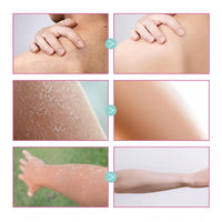 Xunzhi Skin Cream,Skin Cream Intimate Area,Body C/ream for Women,Intimate Area Dark Spot Corrector Lightening C/ream for Body,S/kin Lightening Cr/eam f/or Underarm,Whitening Cr/eam,Cre/am f/or Dry Sk/in