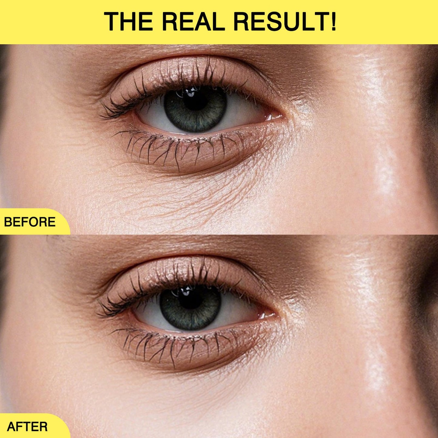 Retinol Eye Cream,Under Eye Cream for Dark Circle & Fine Lines,Hydrating