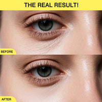 Retinol Eye Cream,Under Eye Cream for Dark Circle & Fine Lines,Hydrating