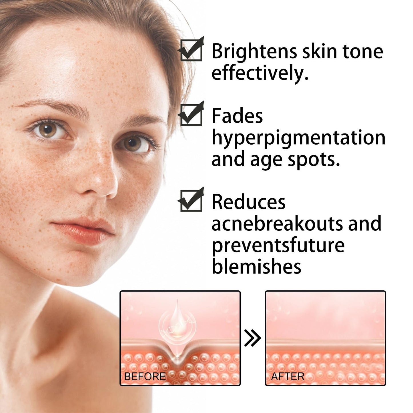 Siyinzu Dark Spot Correcting Glow Serum,5% Niacinamide Serum,Brightening Dark Spot Ser/um,Dar/k Spo/t Remover for Face,Anti-Aging Ser/um,Hydrating Facial Se/rum,Skin Care S/erum for Age/Sun Spots/Acne Marks
