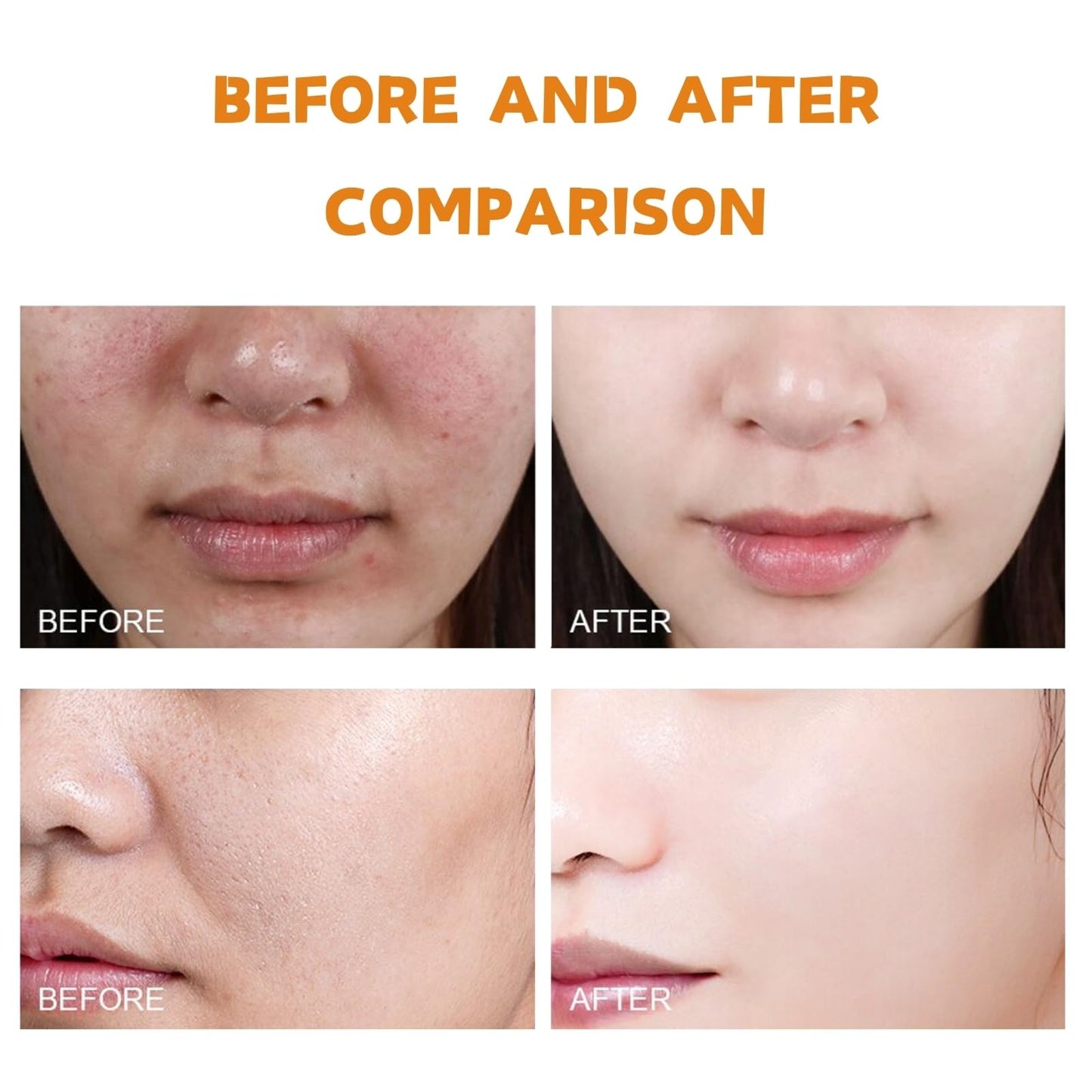 Face Exfoliator - Salicylic Acid Face Scrub - Exfoliating Face Wash for Blackhead Remover & Reduce Acne - Clean and Clear Face Wash Women - Salicylic Acid Cleanser - Hydrating Face Scrub Exfoliator