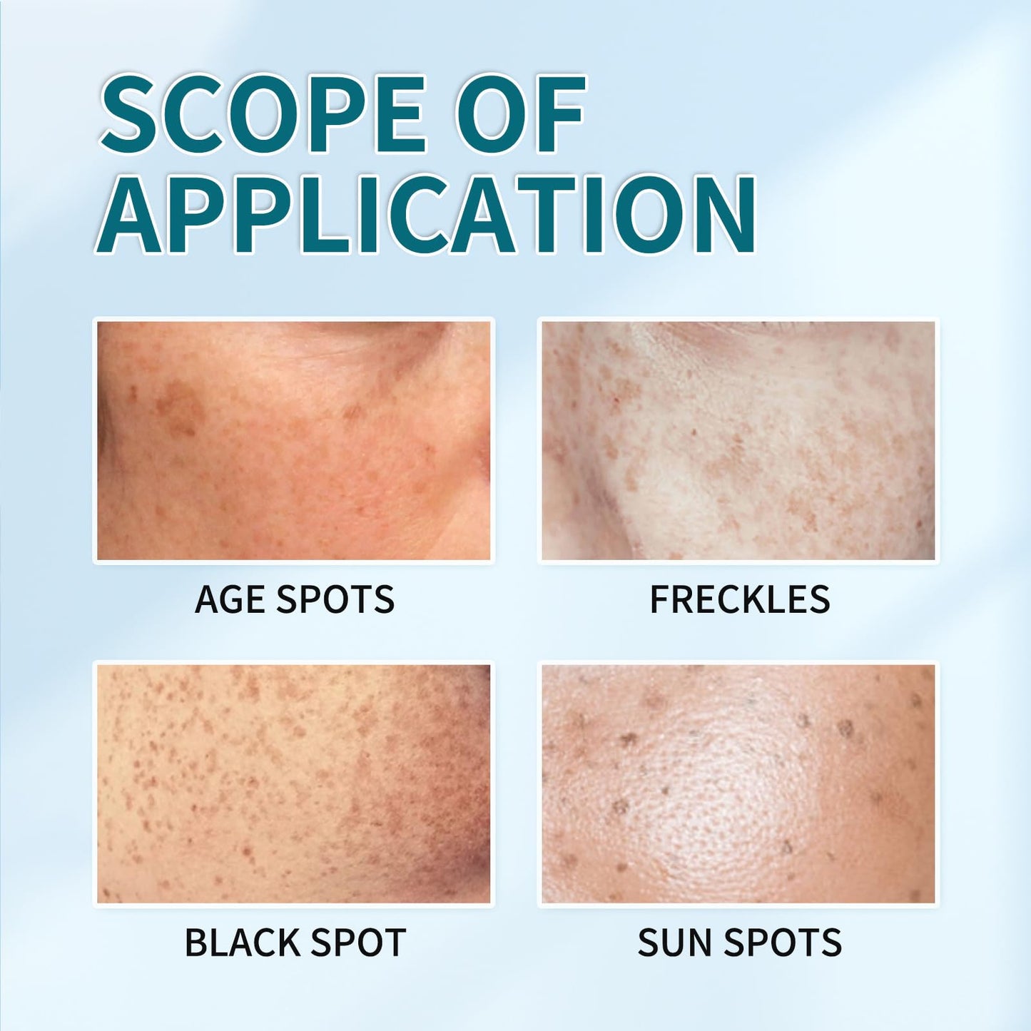 GNAUMORE Freckle Remover Cream,Dark Age Spot Remover,Spot Cream Dark Spot Corrector,Reduce Dark Spots & Soften Skin,Hyperpigmentation Treatment,20g