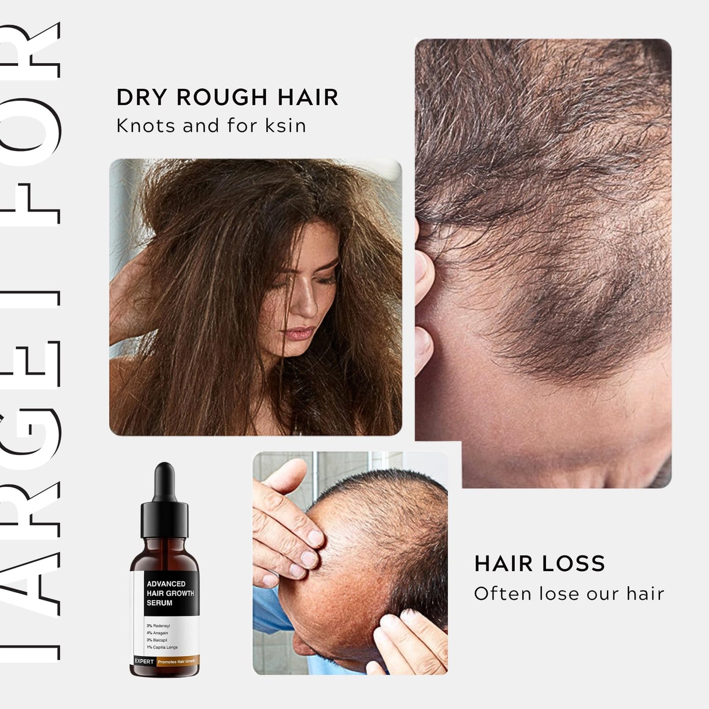 Lumiter Advanced Hair Growth Serum, Hair Growth Oil with Rosemary+Biotin+Redensyl+Anagain +Baicapil, Stimulate Hair Regrowth, Increase Hair Density, Hair Loss Treatments for Women Men, 30ml