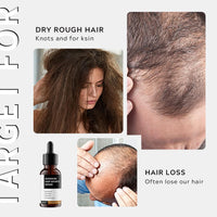 Lumiter Advanced Hair Growth Serum, Hair Growth Oil with Rosemary+Biotin+Redensyl+Anagain +Baicapil, Stimulate Hair Regrowth, Increase Hair Density, Hair Loss Treatments for Women Men, 30ml