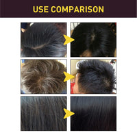 SingHao Hairfi/llup Hair Concealer,Hair Building Fibres for Thinning Hair,Hair fi/llup Hair Concealer,Professional Hair Building Fibres,Hair Loss Conce/aler,Ha/ir Fibers for Men,H/air Con/cealer for Men