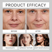 Siyinzu 4PCS Deep Collagen Retinol Tension Boost up Mask,Retinol Collagen Lifting Mask,V-Line Lifting and Face Tightening Ma-sk,Bio Collagen Ma-sk Overnight,Deep Moisturizing Colla-gen Face M-ask for Women