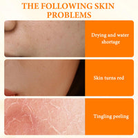 KDJXZ Turmeric Soap 2 Pieces Tumeric Soap Acne Dark Spot Smooth Skin, Turmeric Soap Bar, Turmeric Handmade Soap Bar Suitable for Moisturizing Restoring Elasticity Luster and Tightening Pores