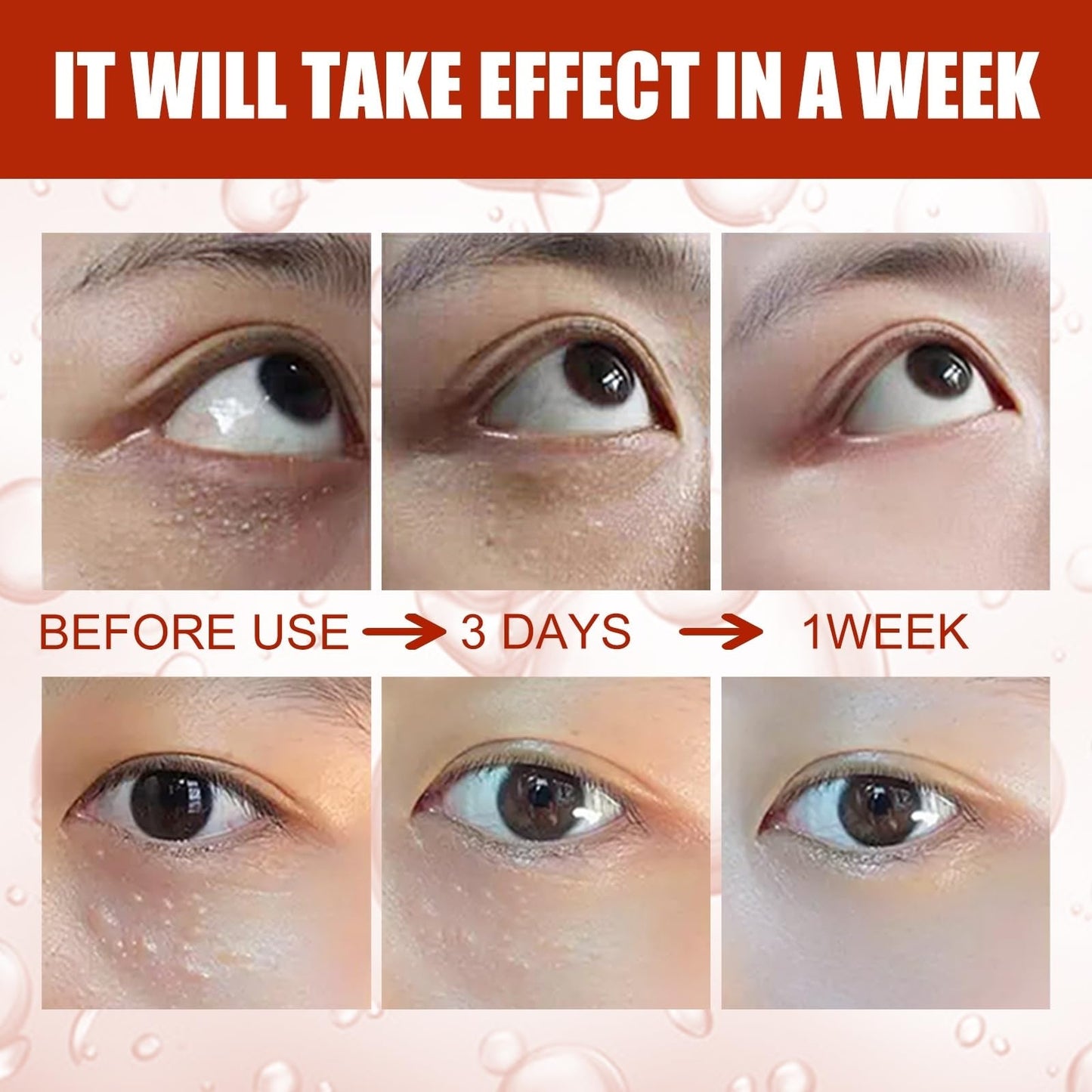 Fat Granules Removal Eye Serum,Anti-Aging & Anti-Wrinkles Under Eye Serum,Eye Ser-um for Dark Circles & Puffy Eyes,Tightening & Lifting Under Eye Serums,Dark Circle Eye Serums