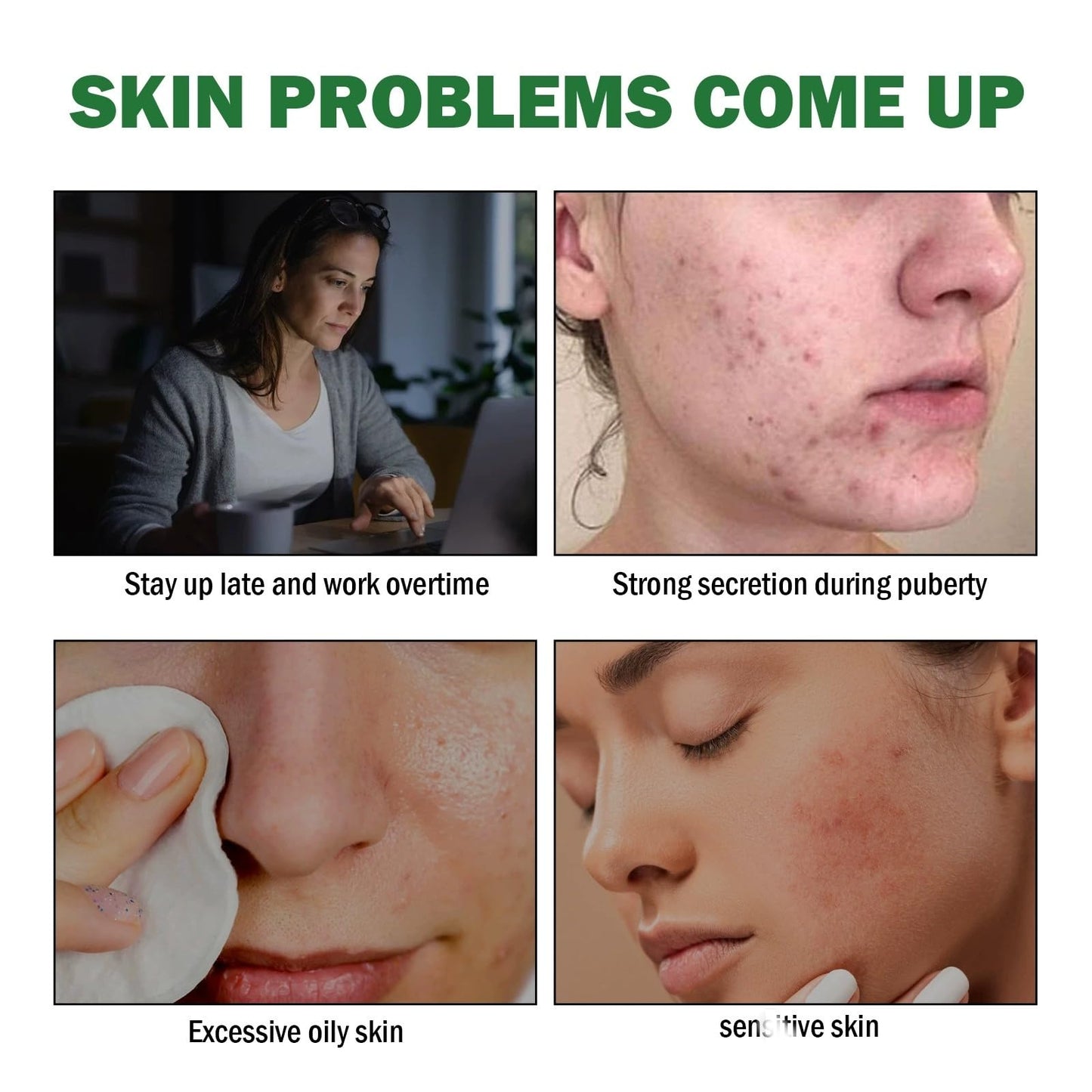 Jinjiar Aze-laic Ac-id 10% Facial Serum,Aze-laic Ac-id Cream for Face,Face Serum for Women,Az-elaic Aci-d Cream Gel,Hydrating Face Cream,Night Moisturiser,Face Cre-am,Night Cr-eam,Fa-ce Care,Skinoren Cre-am