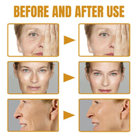 Ruojiar Bee Venom Wrinkle Removal Cream,Face Cream for Women,Bee Venom Anti-Wrinkle Cream,Skin Firming Cream,Bee Venom Skin Treatment Cream,Anti Wrinkle Firming Multi Purpose Cream,Skin Tightening Cream