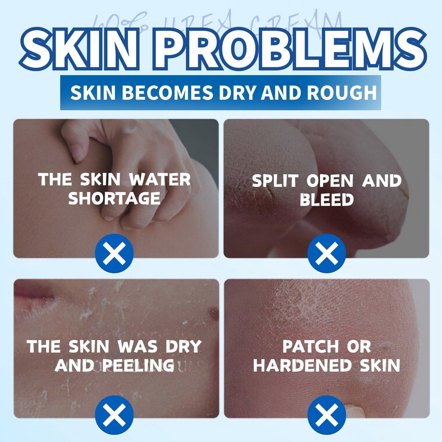 60% Urea Cream - Urea Cream 60 Percent for Feet - Cracked Heel Repair Cream - Ure_a Foot Cream Stick Plus 2% Salicylic Acid For Calluses - Foot Crea_m For Cracked Heels And Dry Skin 1pc
