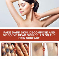 Exfoliating Yellow Peeling Oil for Da-Rk Skin,Body Glow Oil,Exfoliator Body,Brightening Bo-dy O-il,Bo-dy Exfoliate Peeling Oi-l,Whole Bod-y Sk-in Exfoliator,Bod-y O-il for Women,Sk-in Lightening