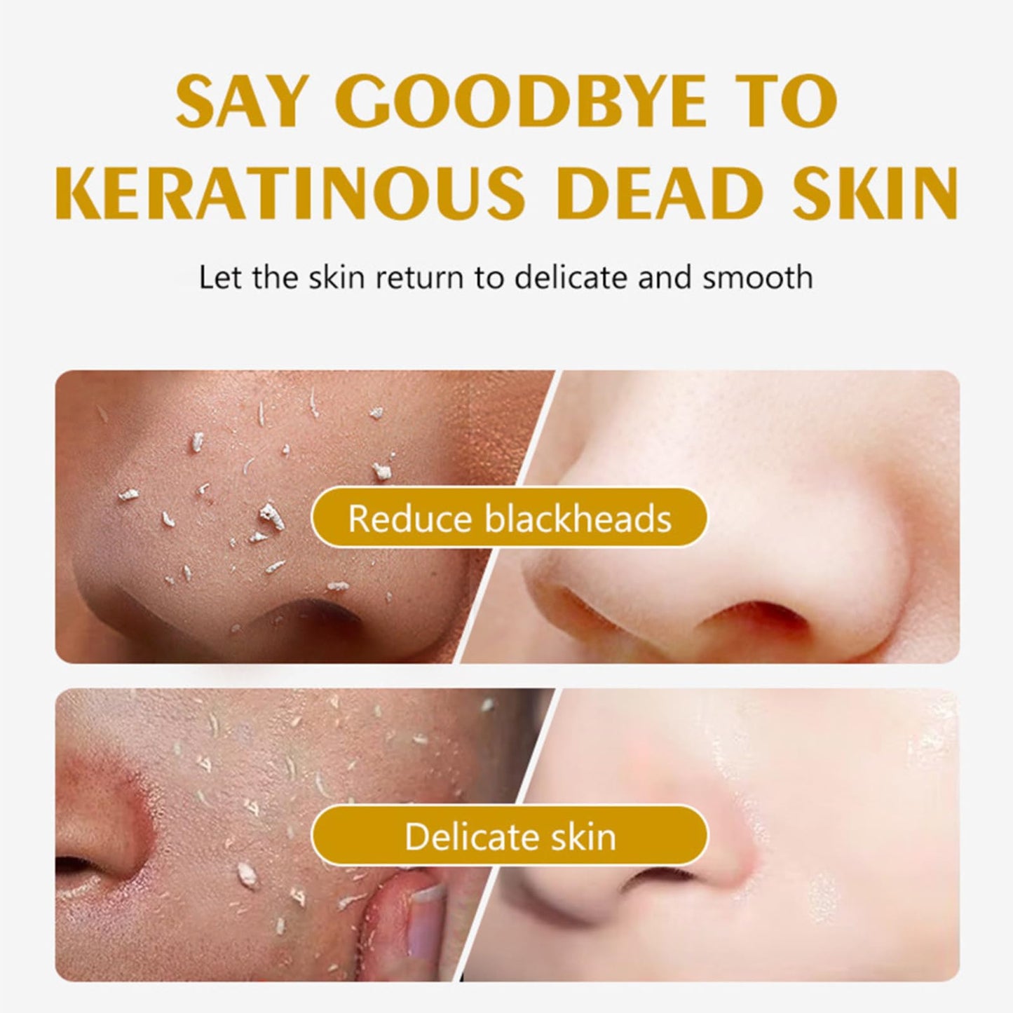 Trendyfave Lemon Peeling Gel, Vita Lemon Face Scrub Exfoliator with Purifying Exfoliating Gel – Vitamin C & Niacinamide for Glowing Skin, Face Exfoliator Scrub for Radiant Skin, Face & Body &Knee (100ml)