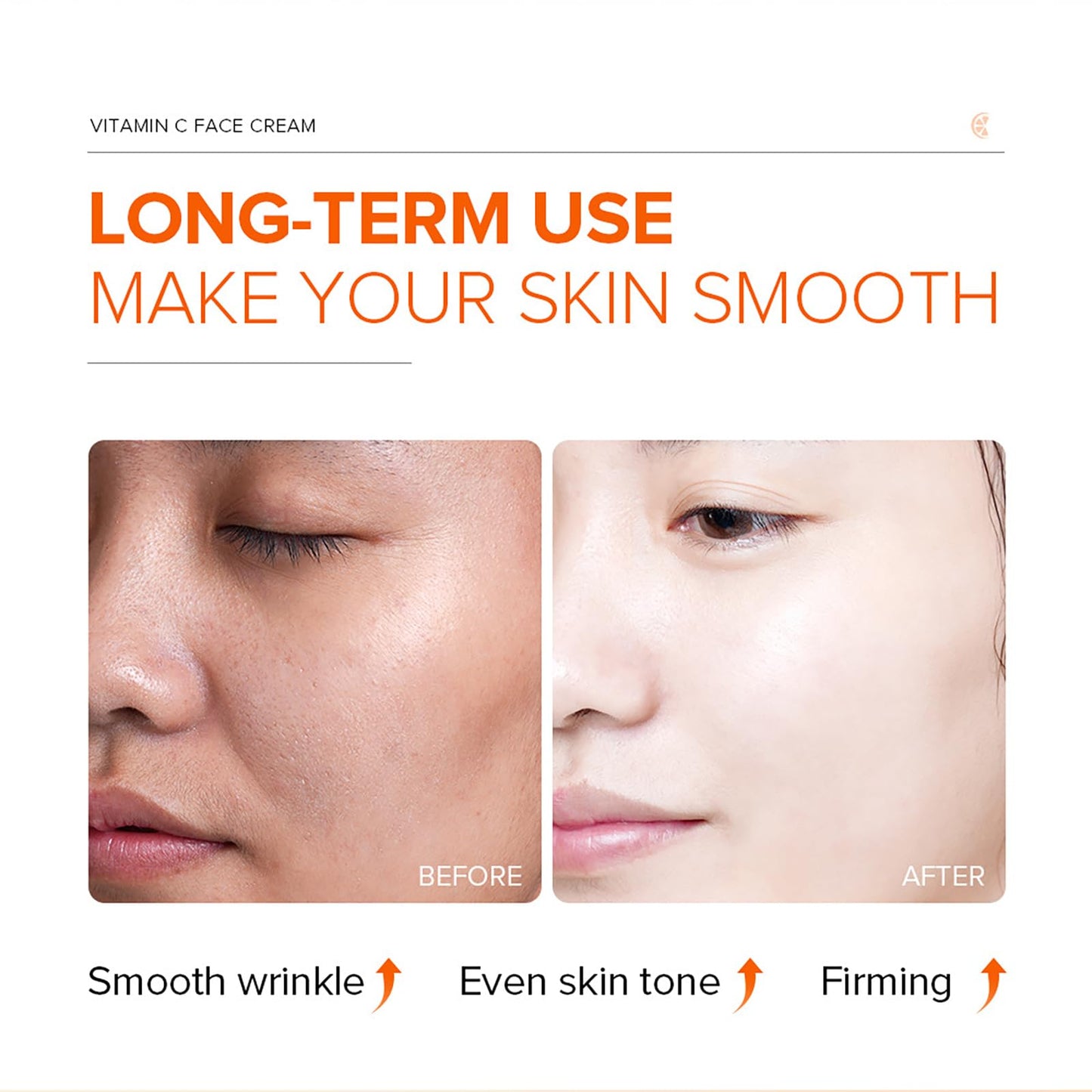 KKwoter Anti-Aging Vitamin C Moisturizer for Face - Day & Night Cream for Women & Men. Brightens & Evens Skin Tone, Boosts Collagen and Reduces Fine Lines. Effective Skin Care Solution