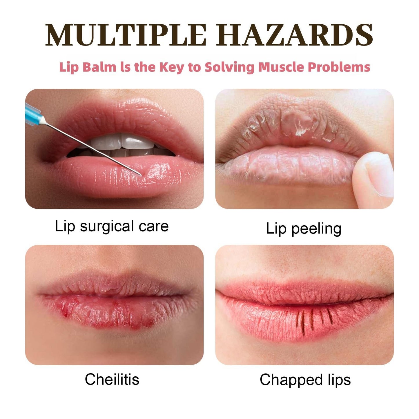 Dark Lips Cream,Lip Balm Lips Pink Bleaching Cream Balm,Lip Lightening for Dark Lips,Li-p Salve for Very Dry Lips,L-ip Lightening C-ream,Wrinkles Repair,Lip Pigmentation Treatment,L-ip Care
