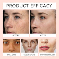 ISBEAUSOLS Glutathione Serum - Kojic Acid Serum for Skin Lig_htening - Dark Spot Correcting Glow Serum - Vitamin C Serum for Face - Hydrating Serum - Facial Serum for Even Skin Tone, Moisturising (30ml)