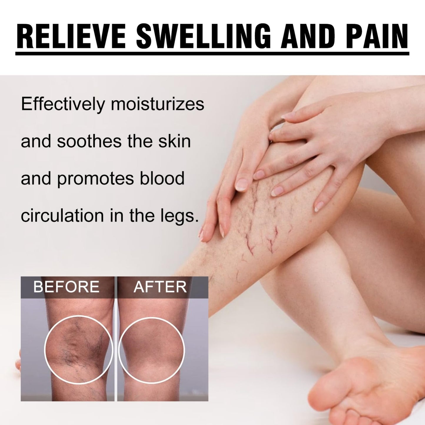 Oumun Care Cream for Legs,Vari/cose Ve/ins Cream,Improve Blood Circulation,Vari/cose Ve/ins Treatment for Legs,Strawberry Skin Treatment,Urea Cre/am Kerat/osis Pila/ris,Cre/am for Dry Skin on Le/gs