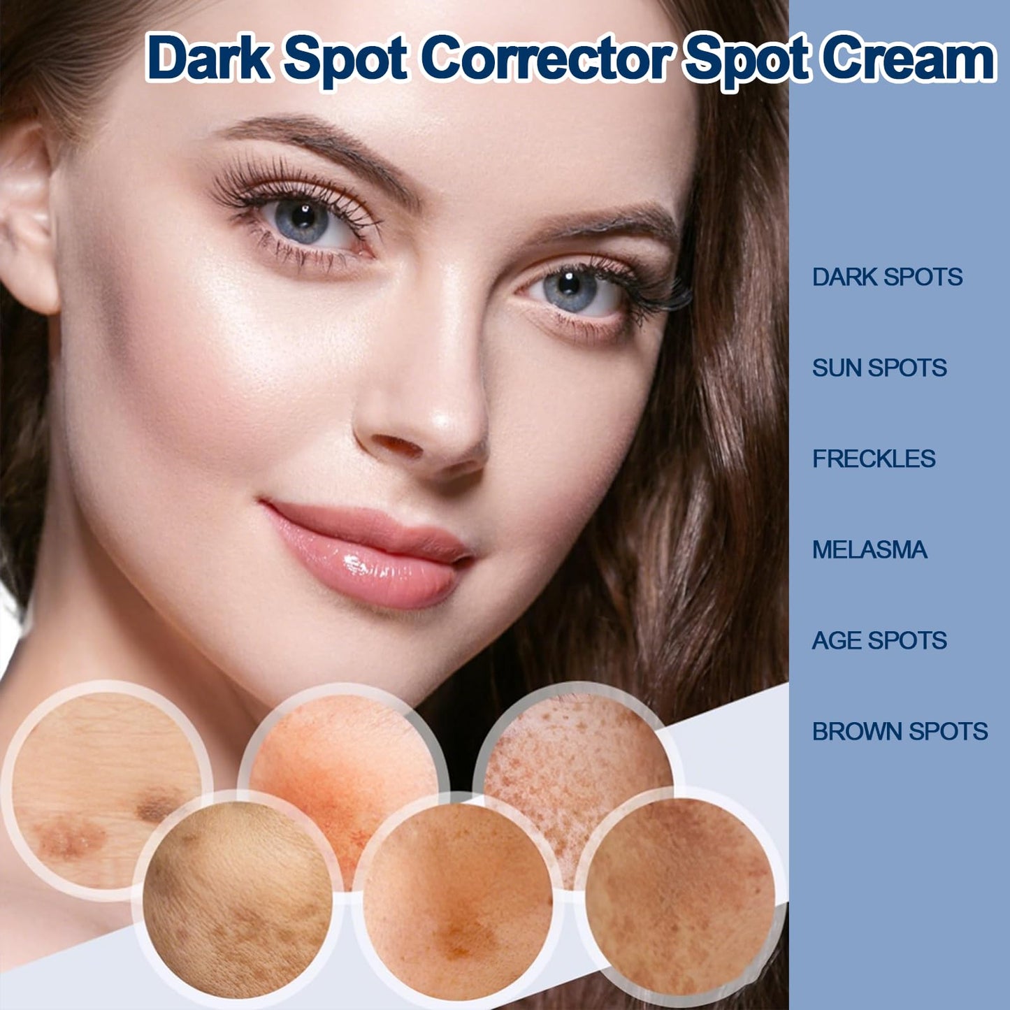 Trendyfave Dark Spot Remover for Face & Body, Dark Spot Corrector Cream with Collagen & Vitamin E, Hyperpigmentation Treatment for Even Skin Tone, Fades Sun Spots, Freckles & Blemishes, Gentle Moisturiser, 50ml