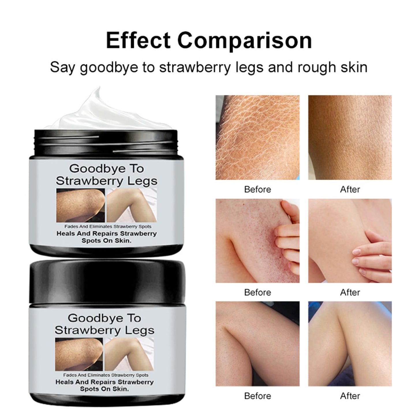 Strawberry Legs Treatment - Exfoliates & Moisturizes for Smooth Skin. Body Lotion for Rough, Uneven Texture Body Cream