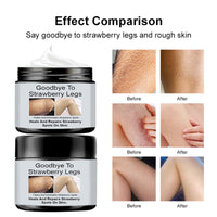 Strawberry Legs Treatment - Exfoliates & Moisturizes for Smooth Skin. Body Lotion for Rough, Uneven Texture Body Cream