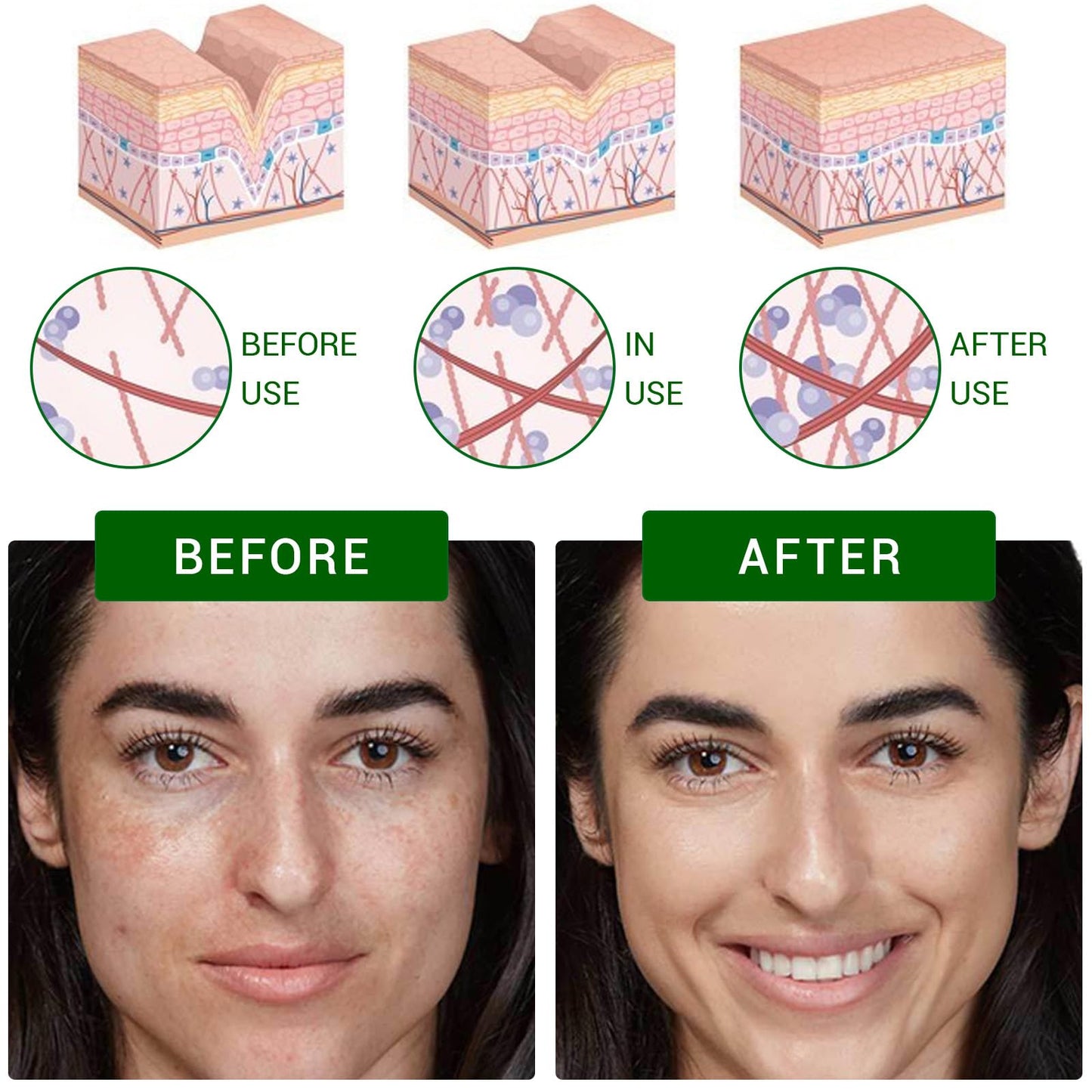 Bettinay Dark Spot Correcting Glow Serum, Dark Spot Remover for Face Pore Refining, Fades Acne Marks Pits