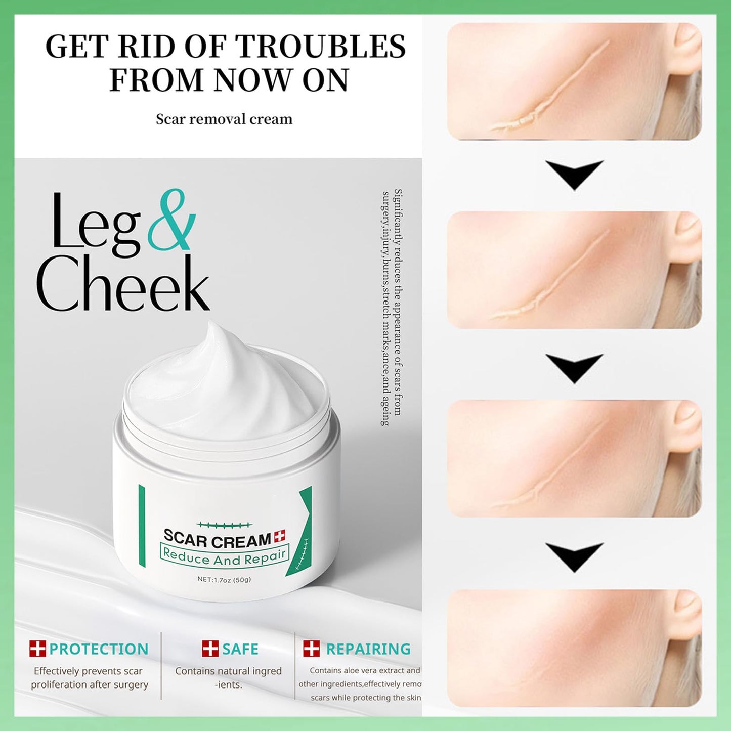 Scar Removal Cream for Face & Body - Treatment for New Scars, Stretch Marks, Acne Spots & C-Sections Treatment Cream, 50g, Natural Formula for Face and Body, Reduces Old and New Scars