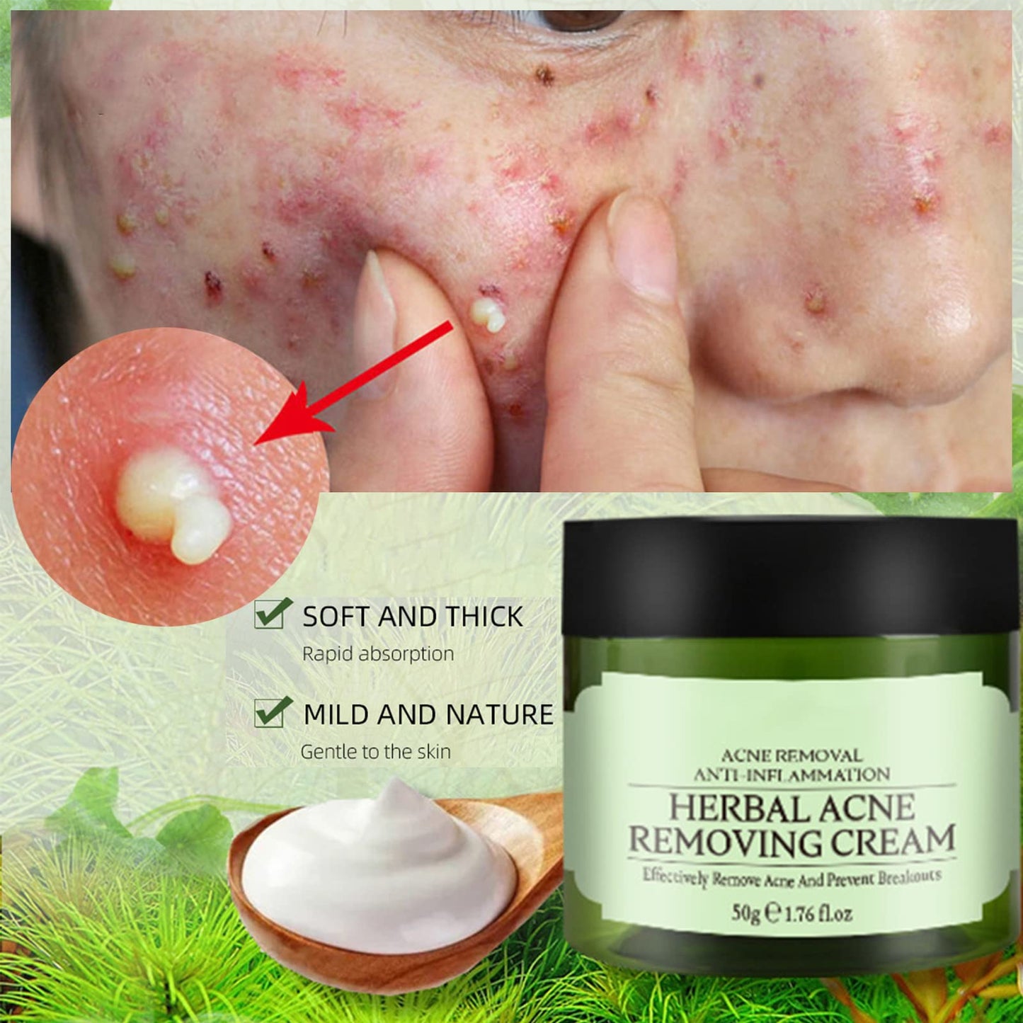 Acne Cream,Moisturiser Face Cream Spot Cream Mens Moisturiser Tea Tree Cream Spot Cream For Acne Cream Moisturiser for Women Men Teenagers Dilute Face Prone Spot Marks Balance Facial Oil Cream